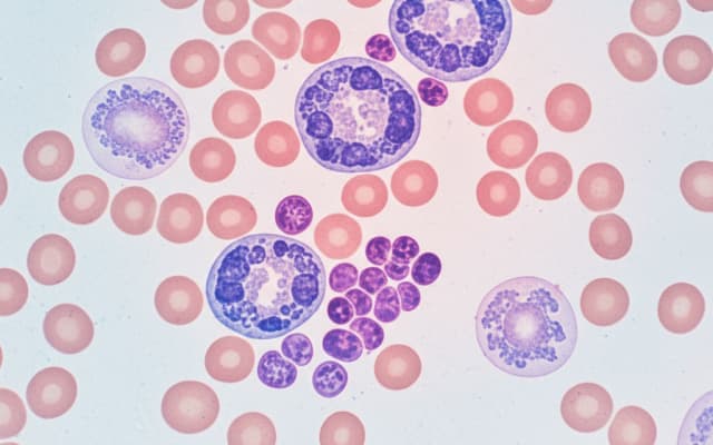 erythroblasts-in-b12-deficiency-an-ominous-sign