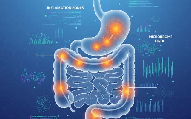 predicting-loss-of-response-in-crohn-s-disease-novel-endoluminal-parameters